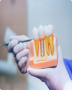Dental implants