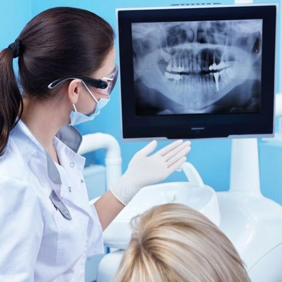 X-Ray