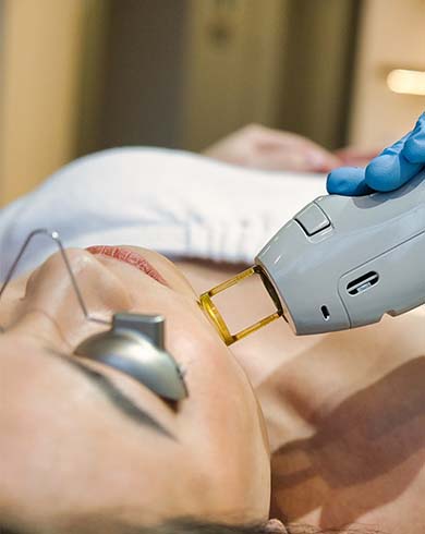 Candela-for-laser-hair-removal-5