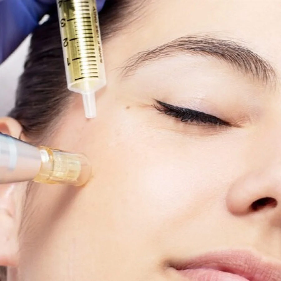 Dermapen-with-Mesotherapy-4